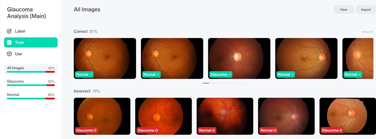 AI Glaucoma training (placeholder)